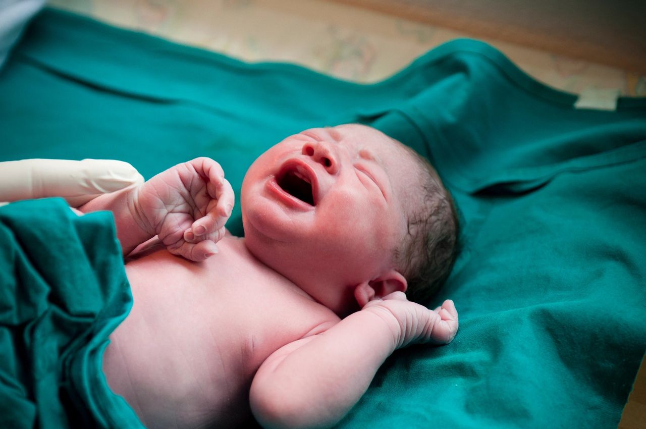 Delayed Cord Clamping: Facts & Phenomenon